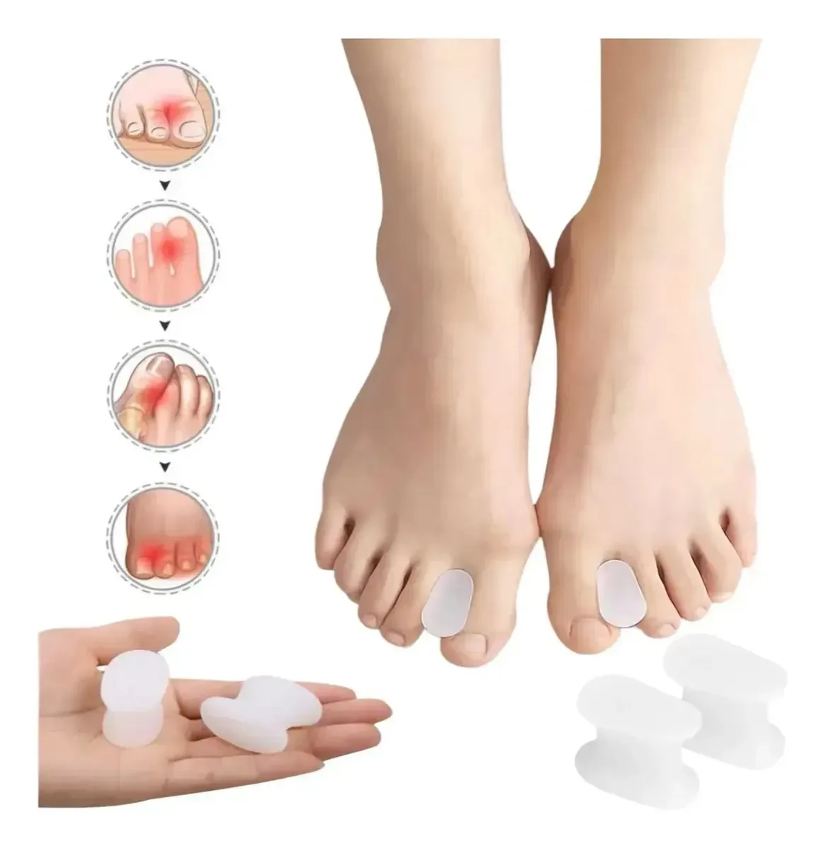 Separador de dedos em gel de silicone Luvina Photo Luv-674 Corretores de joanetes exclusivos