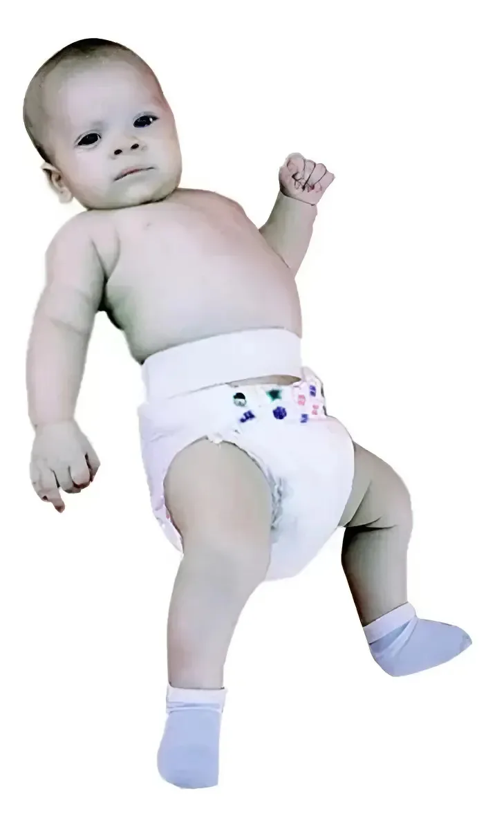 Cinta Faixa Para Hérnia Umbilical Infantil Ortocenter Tamanho G
