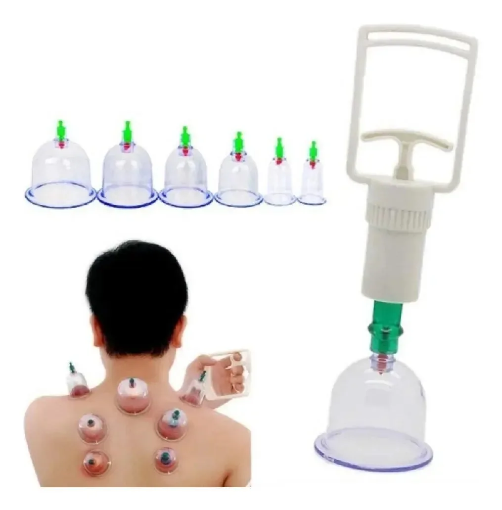 Kit Ventosas Com Bomba - 6 Copos Para Ventosaterapia