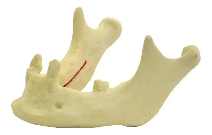 Mandíbula Com Dentes Caninos E 2º Molar Esquerdo Treinamento