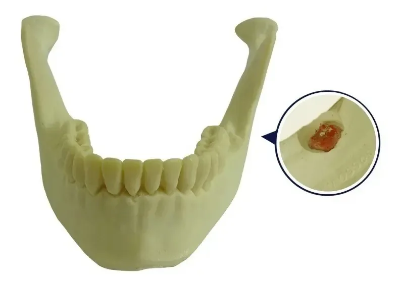Mandibula Com Dente 38 Incluso Ensino E Treinamento Odonto