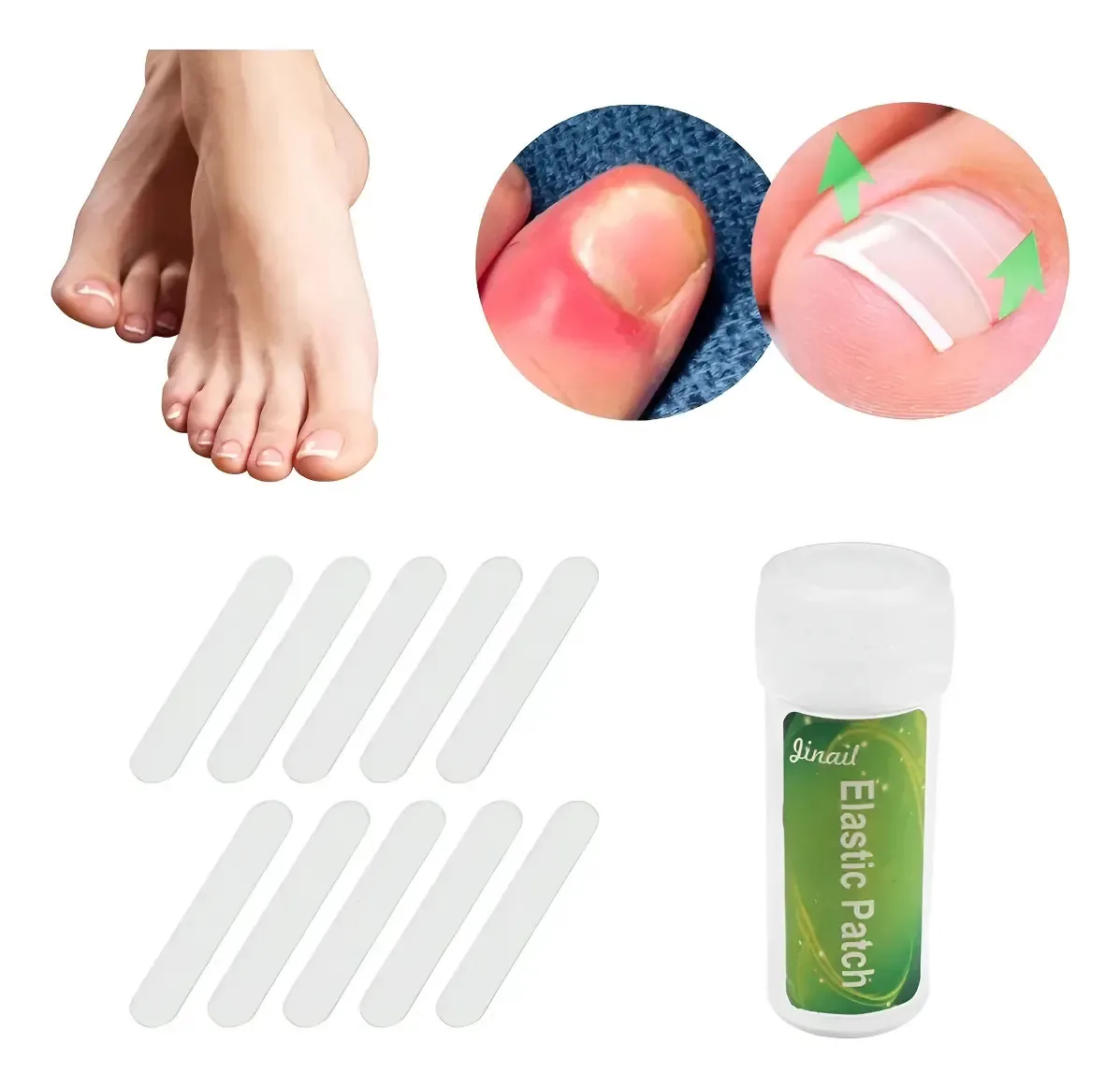 Kit 10 Fitas Corrigir Unha Encravada Memória Molecular Fibra