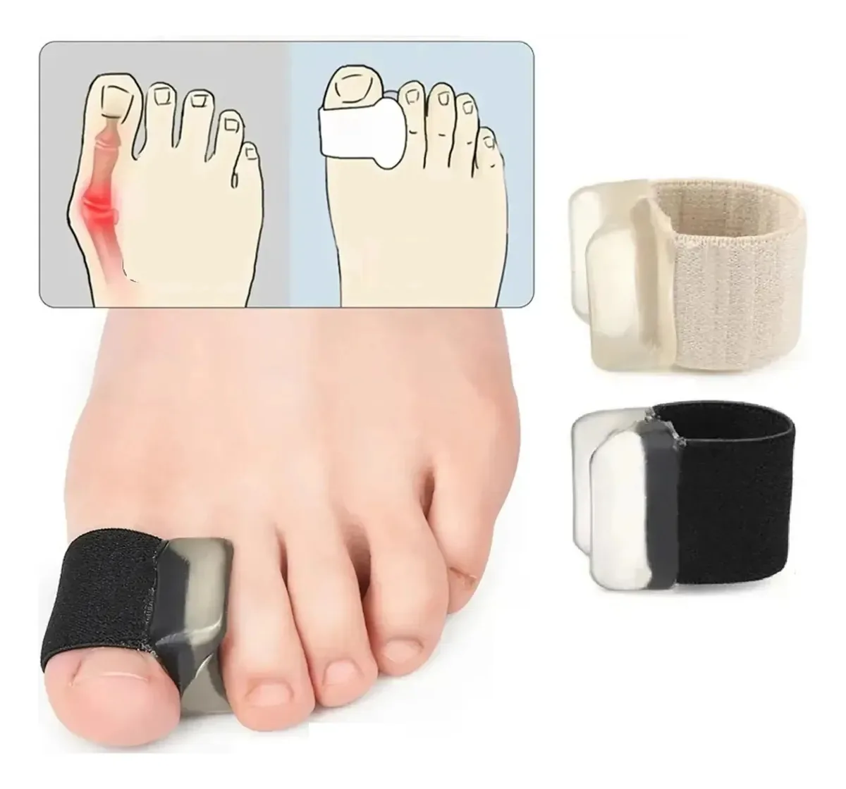 2 Protetor Joanetes Gel Separador Dedos Ajustavel Comforto Preto M