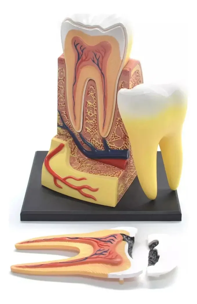 Modelo Anatômico Dente Molar 4D Master Desmontável Estudo Odontologia