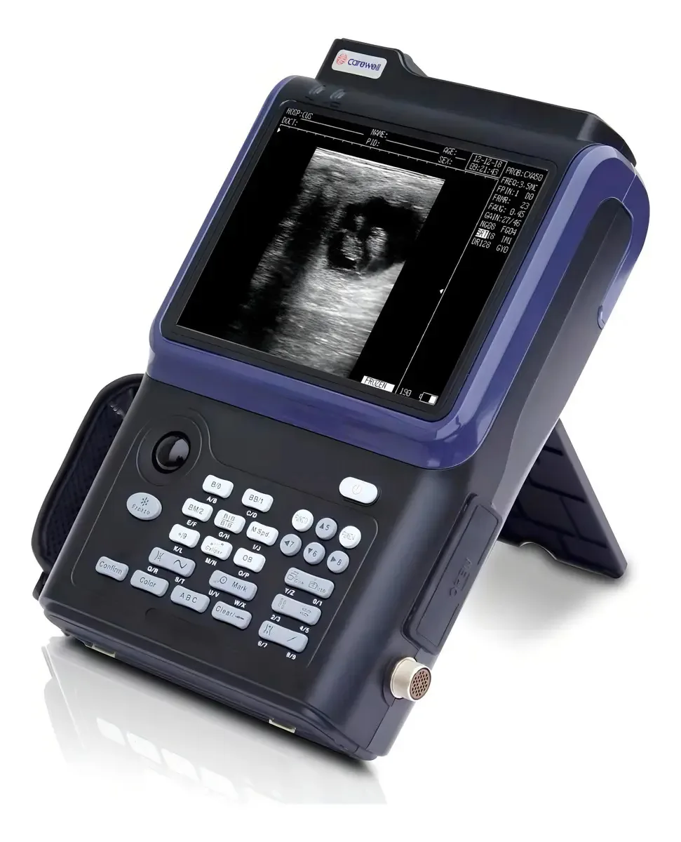 Aparelho De Ultrassom Digital C3 - Carewell