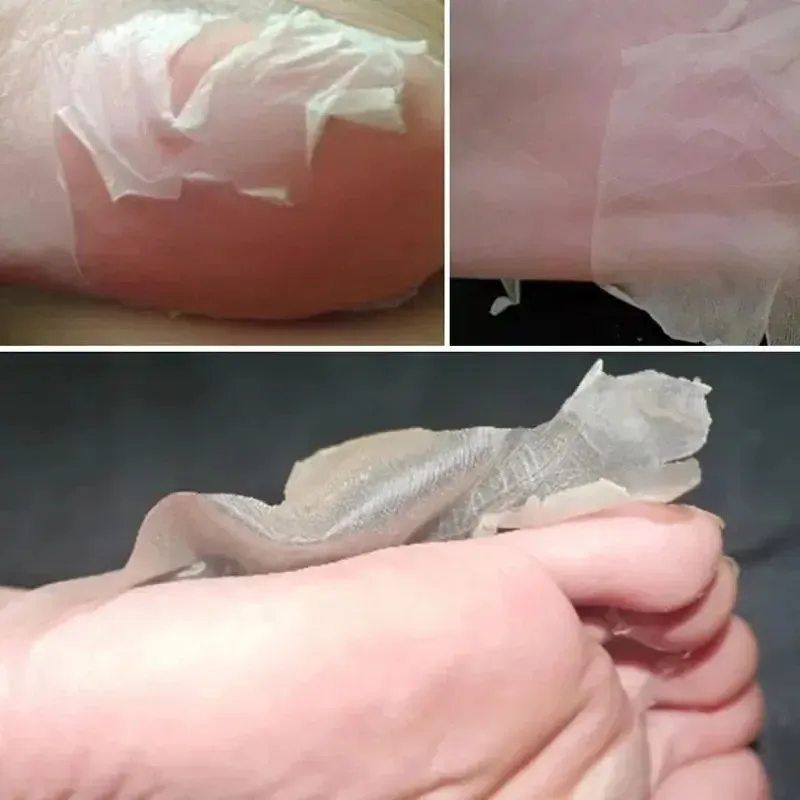 Esfoliante Peeling Pés De Bebe Meias - 2 Pares Renova Pele