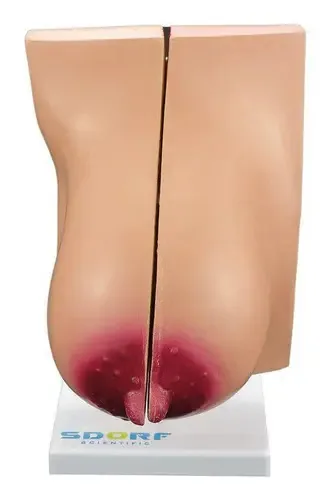 Glândula Mamária em Lactação Sdorf Modelo Anatômico Tamanho Natural