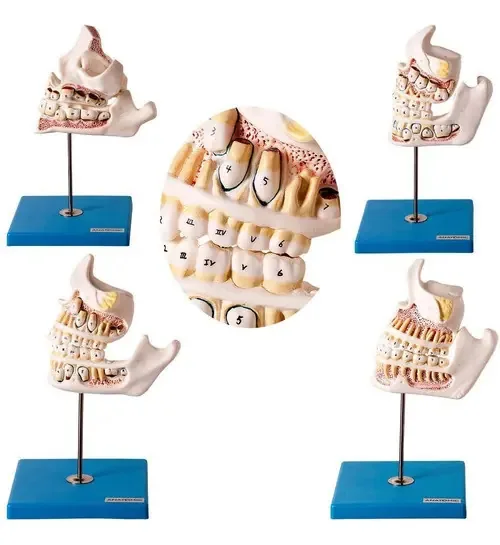 Modelo Anatômico Desenvolvimento Dentição 4 Peças Anatomic