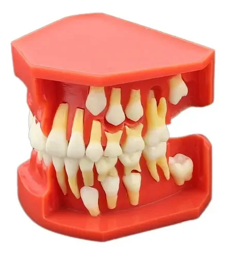 Dentalmall Modelo De Desarrollo De Erupción Dental