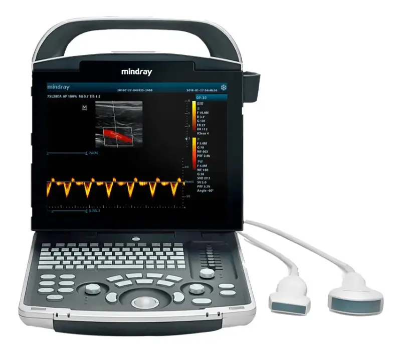 Ultrassom portátil humano Mindray Dp30