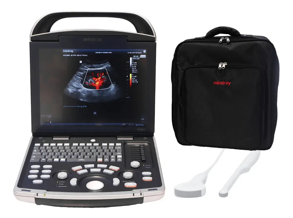 Ultrassom humano+transdutor convex-endocavitário Dp30
