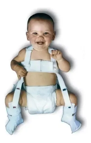 Splint Pavlick, tamanho pequeno