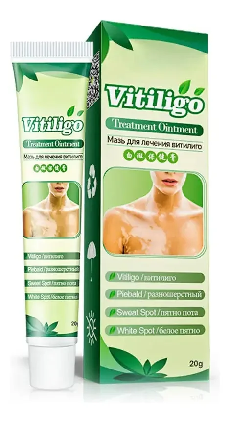 Kedejin 20g de creme para doenças leucoplásicas, bálsamo para pele de vitiligo, creme para cuidados com o corpo e saúde com manchas de suor