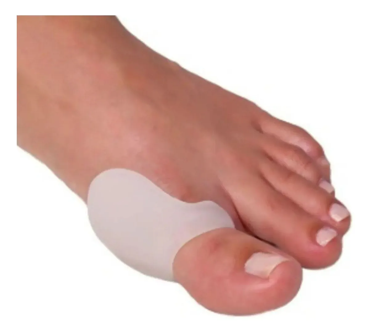 Kit 5 Unds - Protetor De Joanetes - Com Alça - Silicone