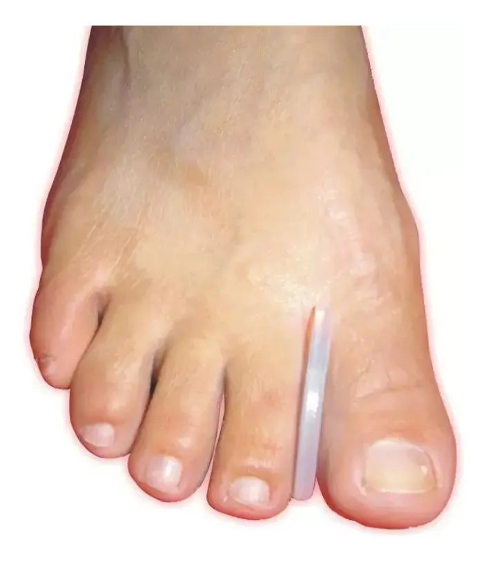 Separador Calos Silicone Transparente - Tamanho P - 4 Unid
