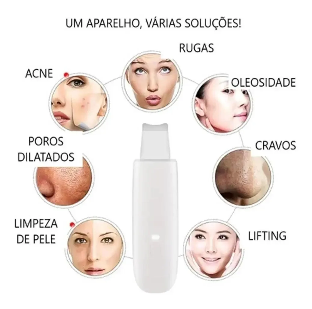 Aparelho Peeling Ultrassónico Portátil Lifting Limpeza Pele