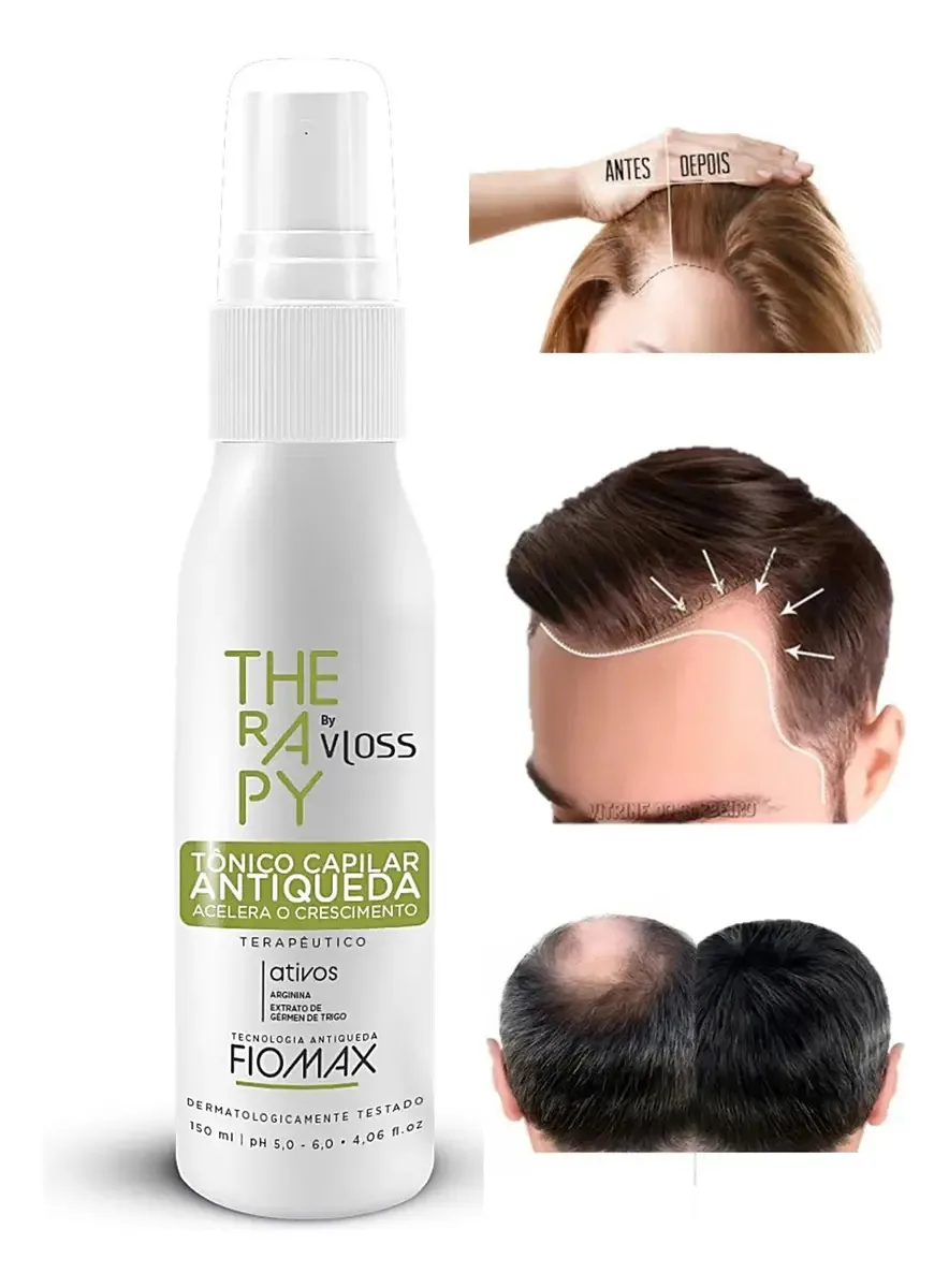 Tônico Capilar Para Crescer Cabelo Fortalecer Engrossar Preencher Falhas Vloss