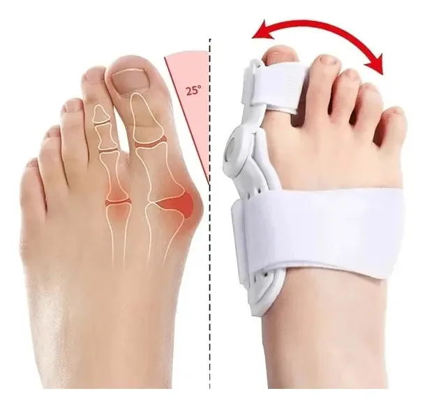 Corretivo de joanete HD SEDUCTION BUNION CORRECTOR travesseiro