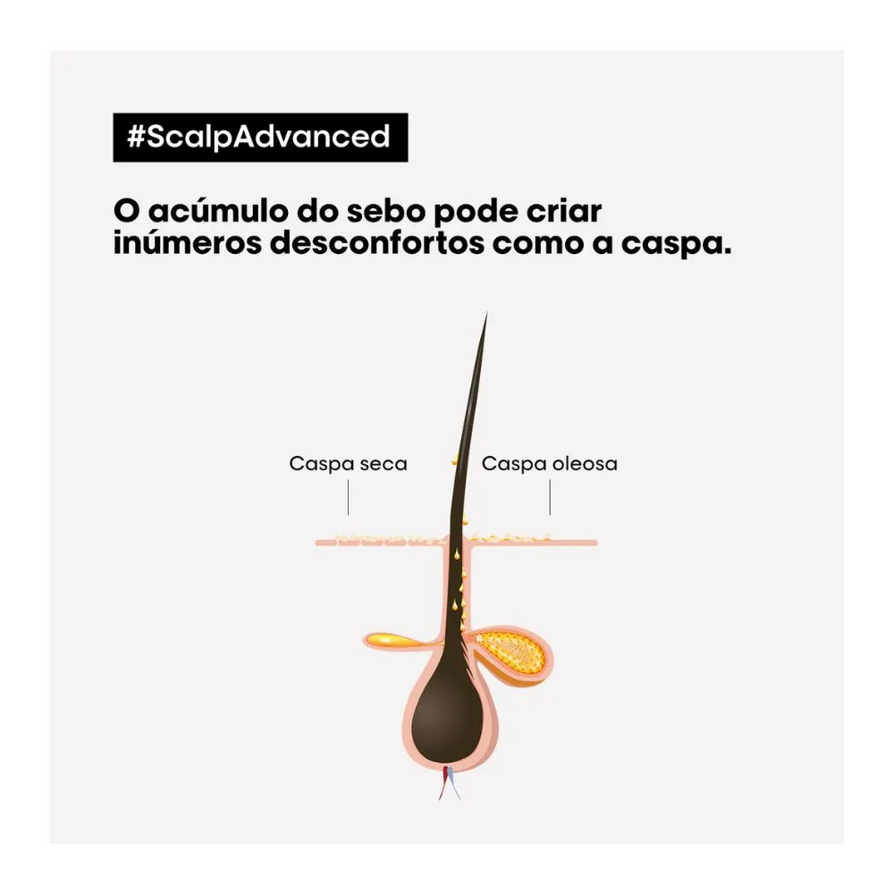 Shampoo Purificante Loreal Prof Se Anticaspa Dermo Clarifier 300ml