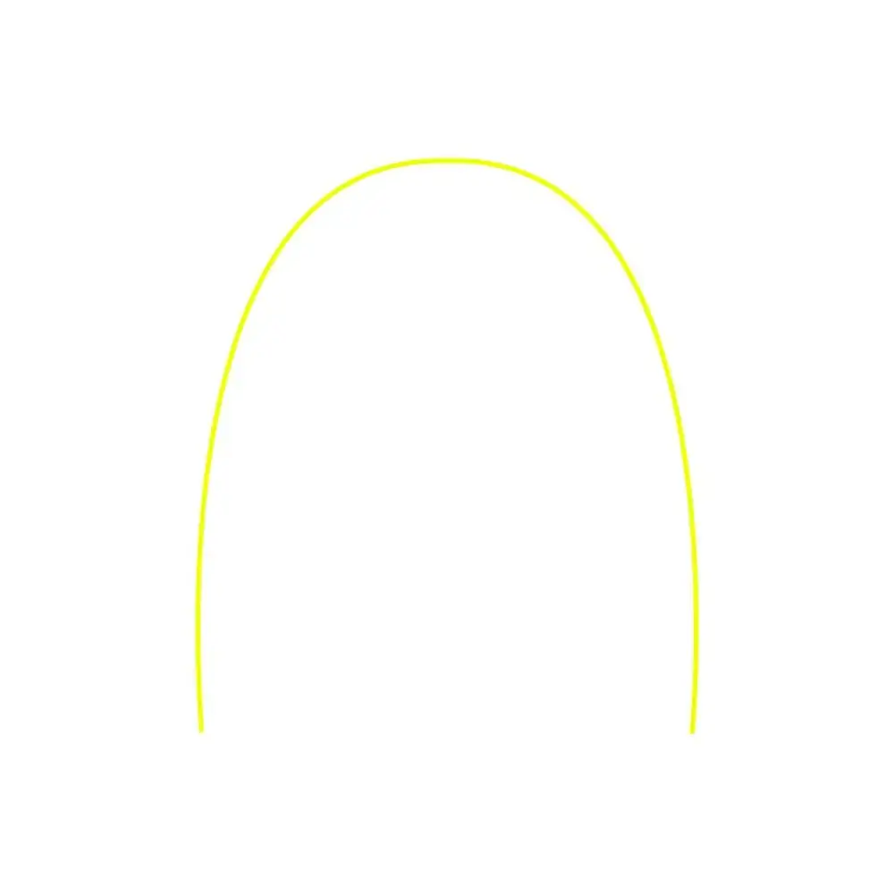 Arco Niti Cosmético Amarelo Inferior - Tecnident - Arco Niti Cosmético Amarelo 0.12 Inferior - Tecni