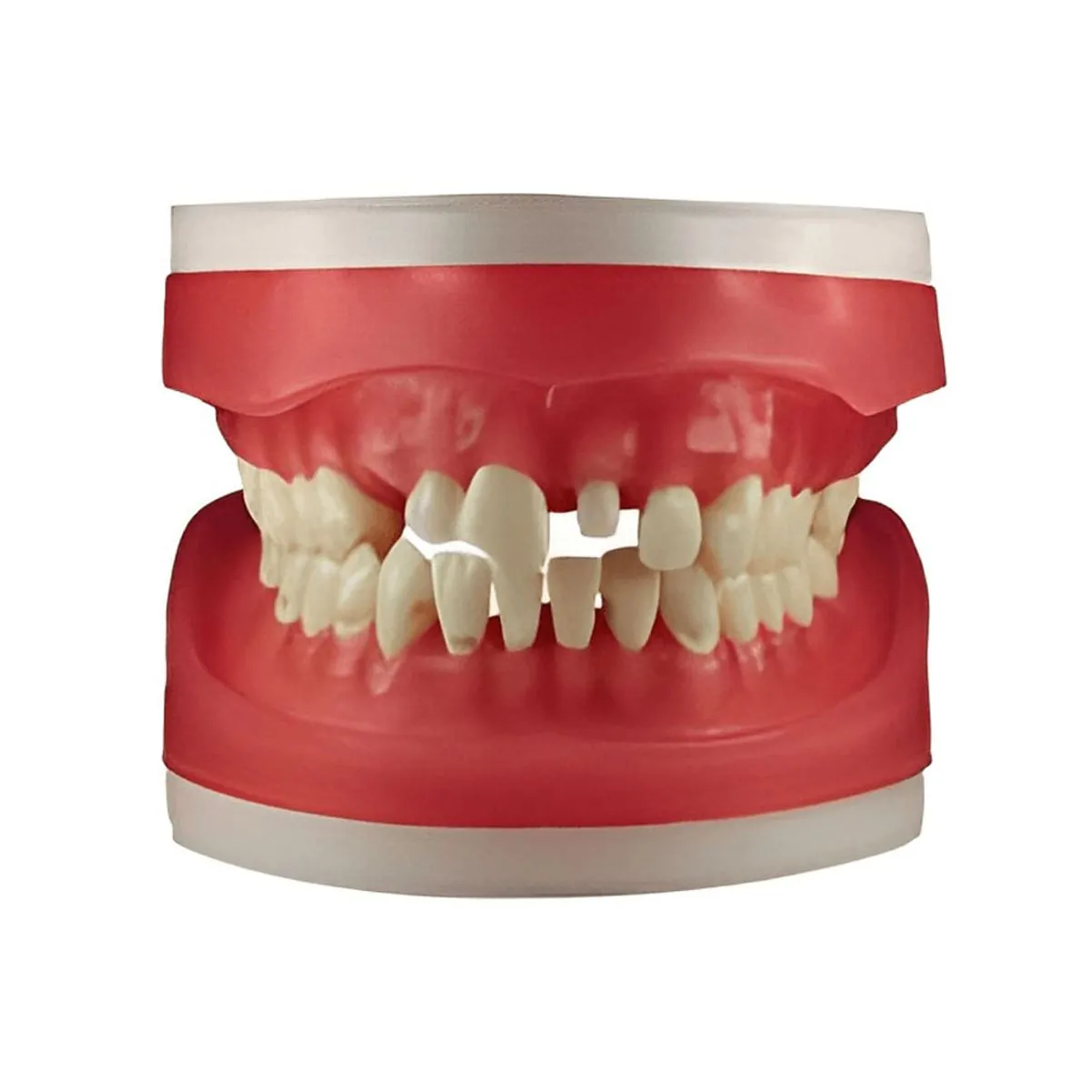 Refil Top Materiais dentários AC100 - Pronew
