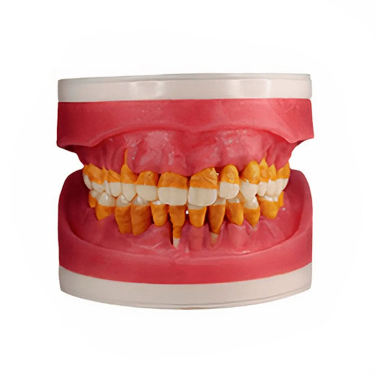 Refil Cirurgia com Dentes de Perio AC025 - Pronew