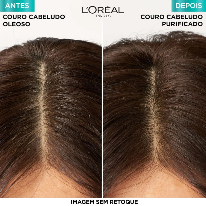 Shampoo Micelar Antioleosidade Loréal Paris Elseve Pure Hialurônico Frasco 300ml
